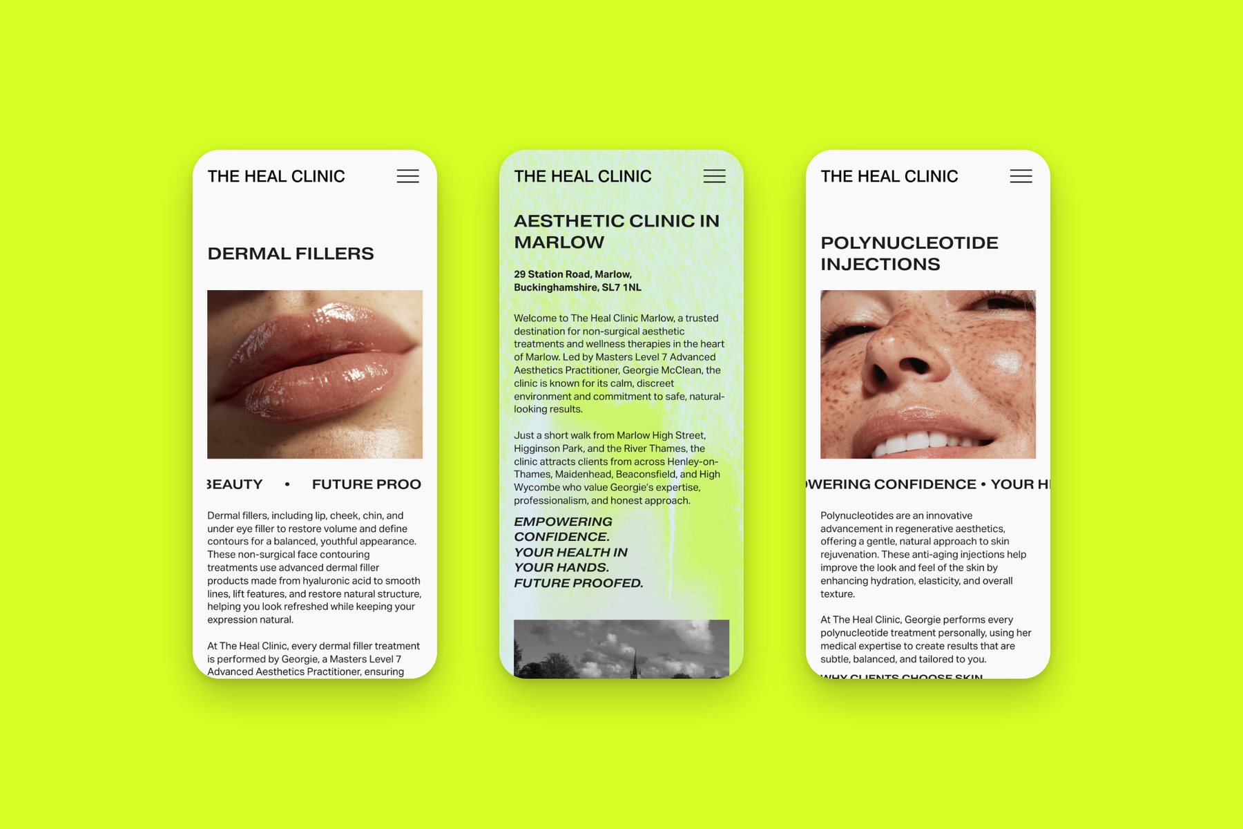 Squarespace website for The Heal Clinic, three live mobile pages on lime