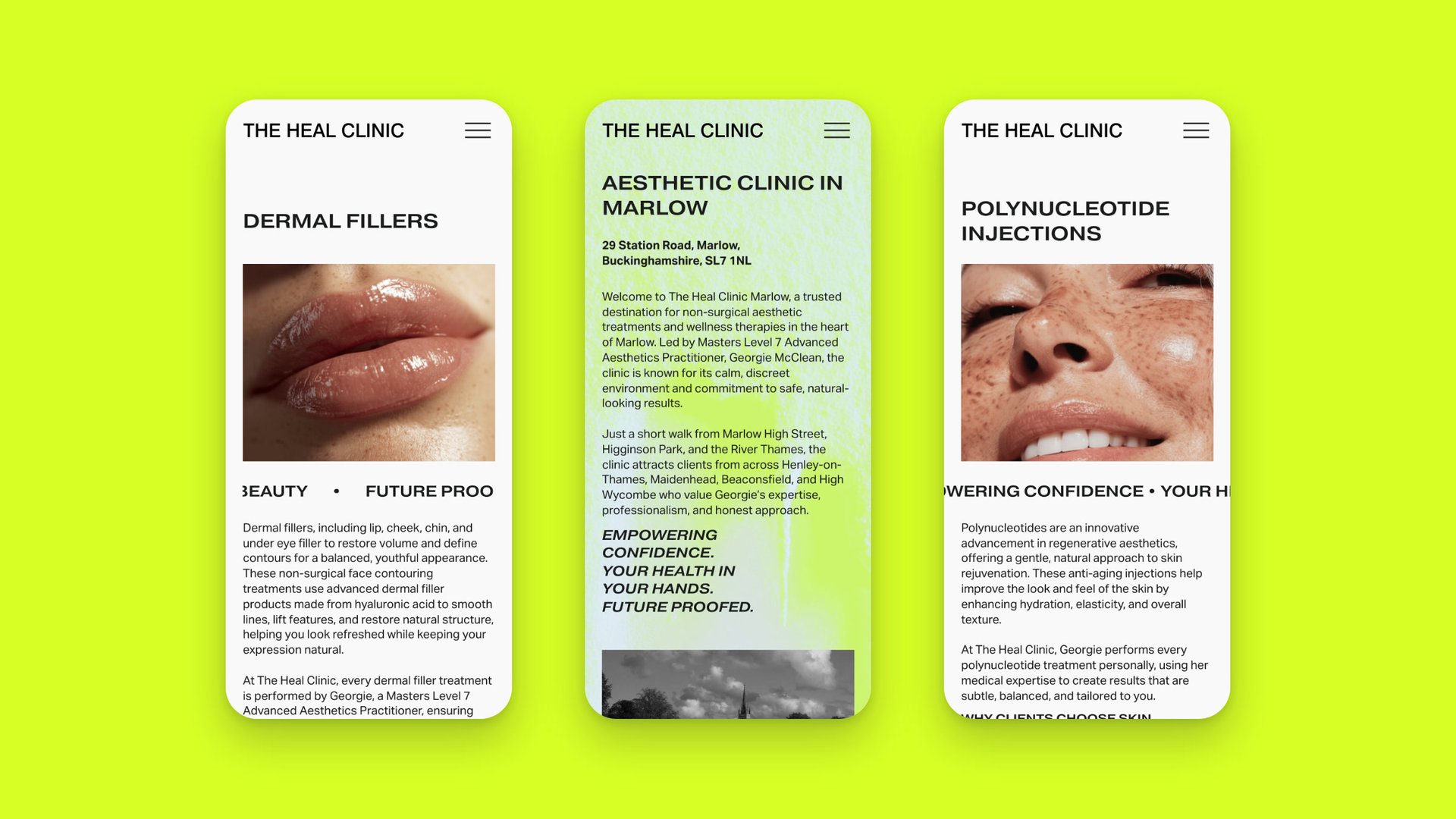 Live Heal Clinic mobile screens on lime: Dermal Fillers, the Marlow clinic and Polynucleotide Injections